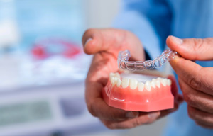 Dentist placing clear aligner on model of lower arch