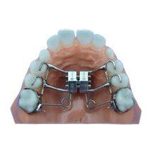 Orthodontist in Cleburne | Braces | Hart Orthodontics